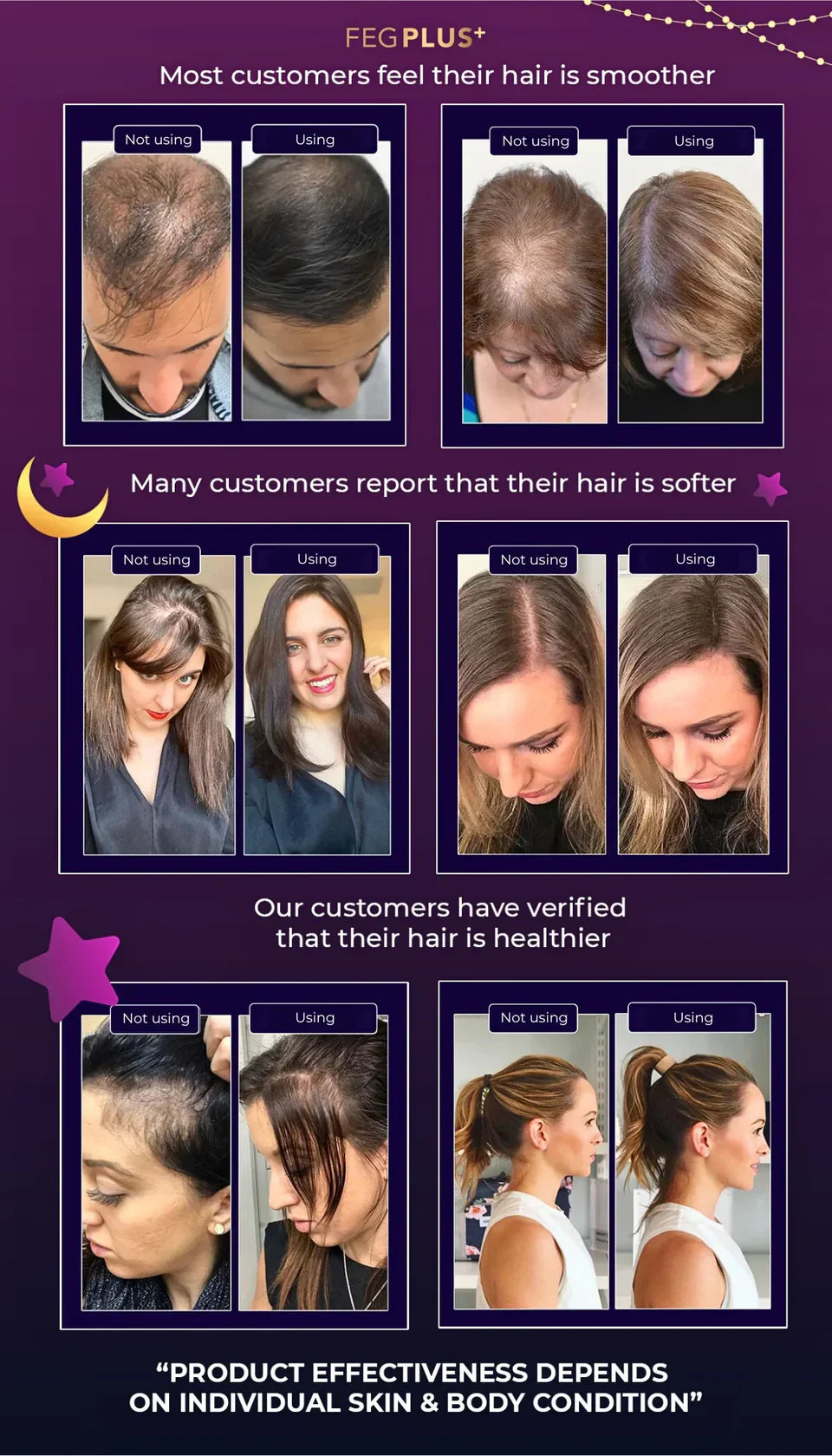 FEG+ Hair Growth Spray - For Men & Women - Original - FDA Approved