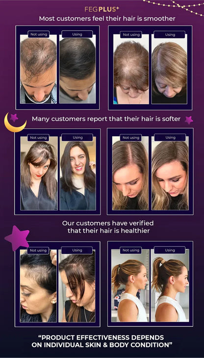 FEG+ Hair Growth Spray - For Men & Women - Original - FDA Approved
